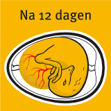 PRLT/Het Kleine Loo